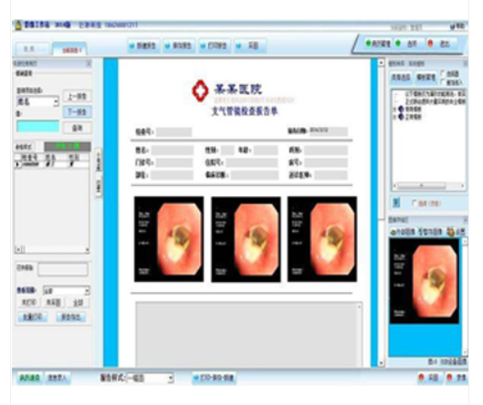 支氣管鏡影像工作站的作用