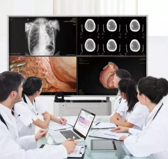 遠(yuǎn)程醫(yī)療影像會(huì)診：跨越地域的醫(yī)療智慧共享