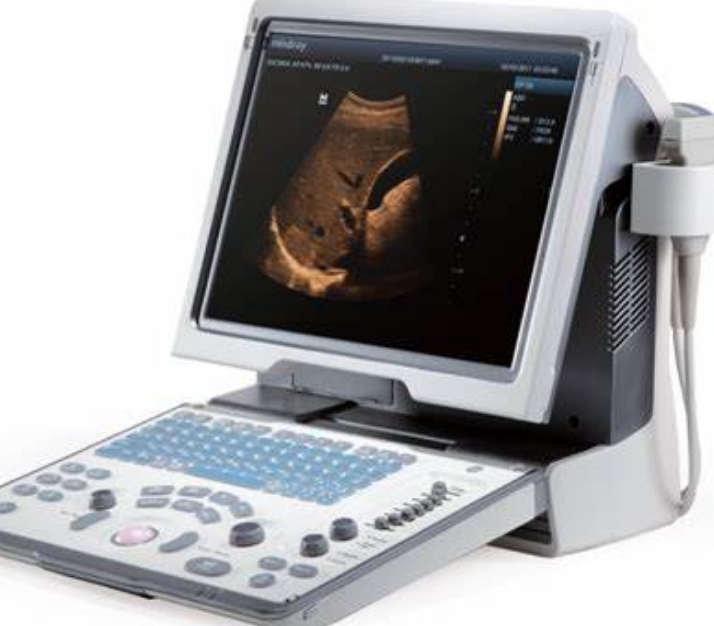 超聲診斷的便攜化革命：隨時(shí)隨地，精準(zhǔn)醫(yī)療觸手可及