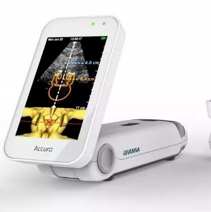 超聲引導穿刺的智能化：精準定位，提升手術安全性