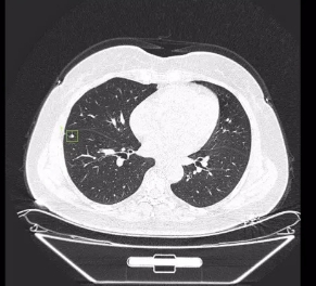 透視生命，洞悉健康：詳解醫(yī)學(xué)影像處理軟件的革新應(yīng)用