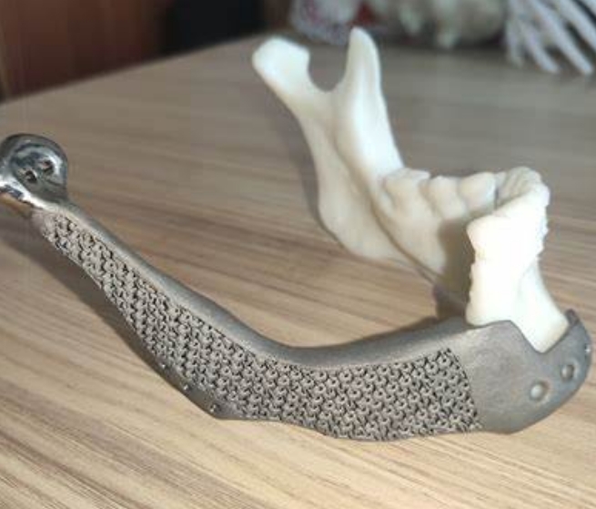 個性化骨科治療的突破：3D打印骨移植材料的應(yīng)用與發(fā)展