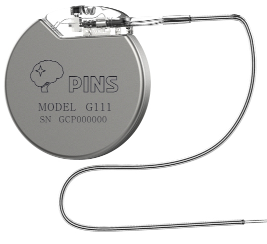 精準(zhǔn)神經(jīng)調(diào)控的未來：迷走神經(jīng)刺激器（VNS）在癲癇治療中的進展