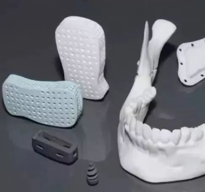 個性化骨科修復(fù)的創(chuàng)新：3D打印生物陶瓷植入物的應(yīng)用與發(fā)展