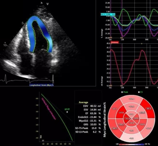 無(wú)創(chuàng)心臟成像的新選擇：實(shí)時(shí)三維超聲心動(dòng)圖設(shè)備的功能與優(yōu)勢(shì)