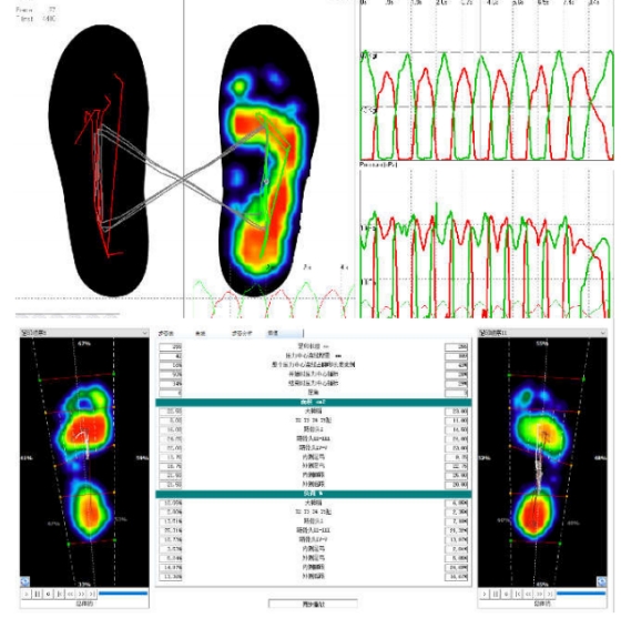 智能康復(fù)訓(xùn)練的創(chuàng)新：可穿戴步態(tài)分析系統(tǒng)的功能與潛力