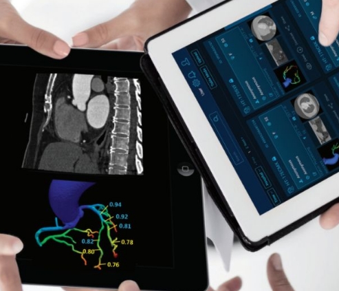 人工智能輔助診斷工具：提升疾病早期發(fā)現(xiàn)率