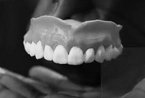 智能假牙技術(shù)：結(jié)合美學(xué)與功能的新突破