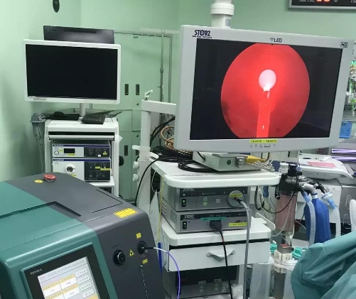 光動力療法設備：針對癌癥的非侵入性治療方案