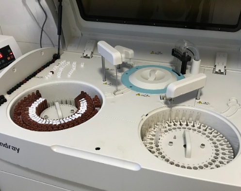 生化指標(biāo)的精準(zhǔn)測(cè)量——生化分析儀在代謝性疾病診斷中的價(jià)值