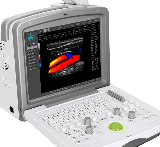 乳腺X光機(jī)：專為乳腺癌早期檢測設(shè)計(jì)的高分辨率乳腺X線攝影設(shè)備