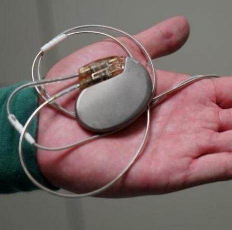 心跳的守護者——心臟起搏器的工作原理與應用