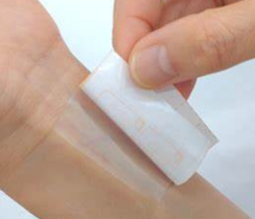 醫(yī)用粘合劑：無(wú)縫連接，安心治療——醫(yī)用粘合劑的種類(lèi)與應(yīng)用