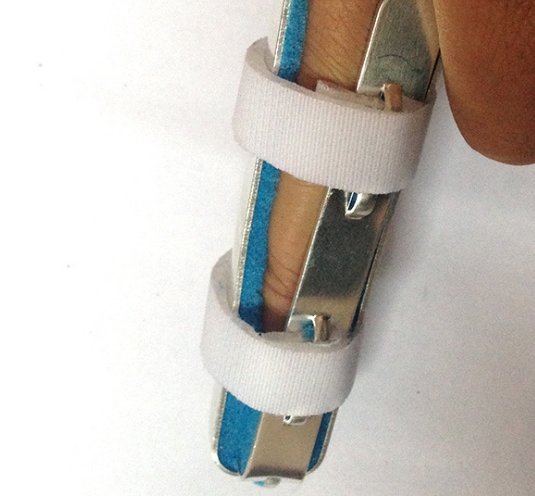 骨折固定板：骨折愈合的支持者——骨折固定板的選擇與手術(shù)技巧