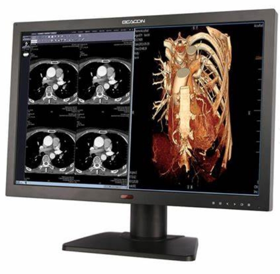 高清顯示，精確診斷——醫(yī)用顯示器的技術(shù)特點及其重要性