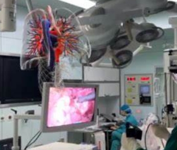 視覺增強，手術(shù)更精準——醫(yī)用AR輔助手術(shù)系統(tǒng)的工作原理與優(yōu)勢