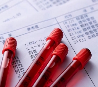 性激素六項分析儀