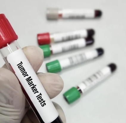 腫瘤標(biāo)志物檢測系統(tǒng)