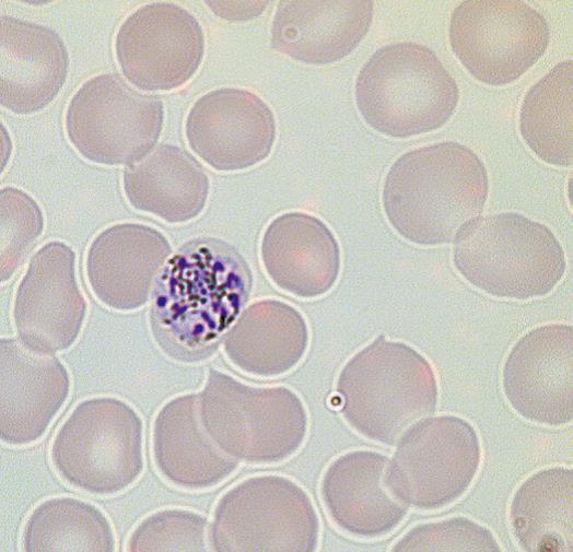 明場(chǎng)，瘧原蟲