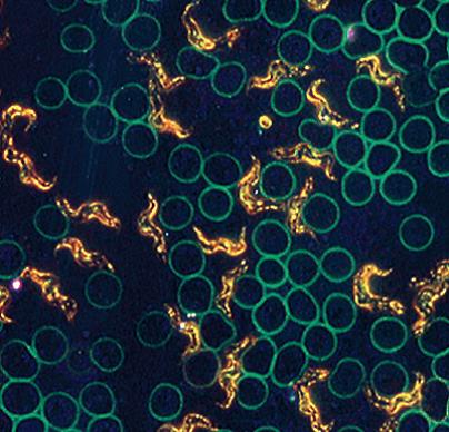 血涂片，暗場(chǎng)