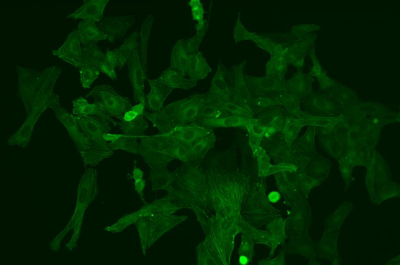 (U2OS細胞，GFP標(biāo)記)放大倍率：20×，熒光觀察