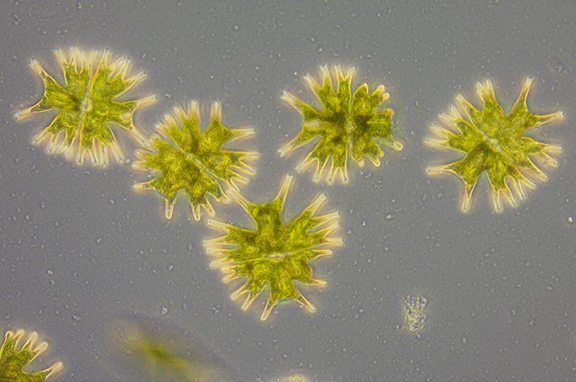 （輻射微星鼓藻）放大倍率：40×，相差